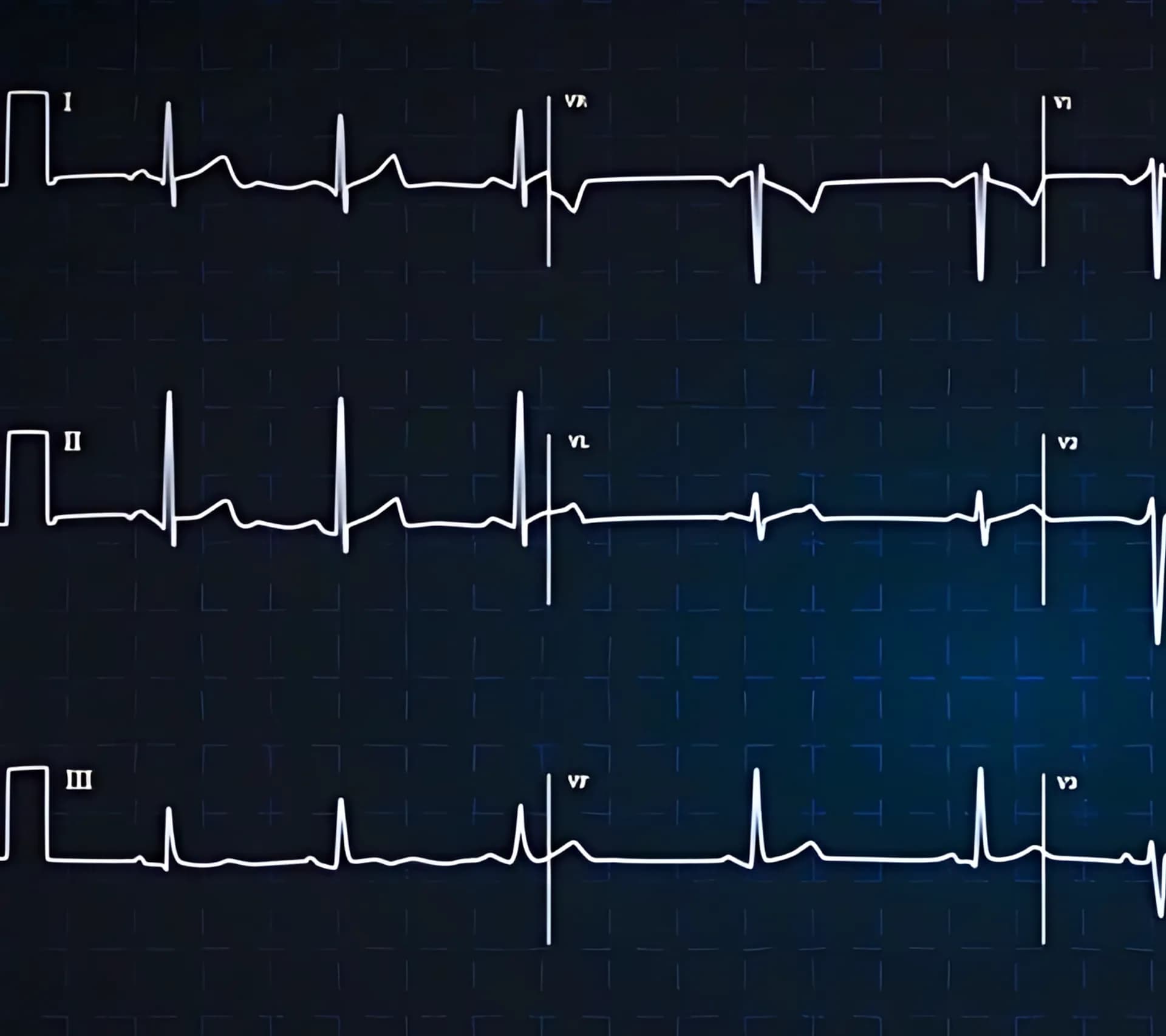 Prevención como base del tratamiento